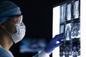 Male doctor in surgical clothes looking at cancer