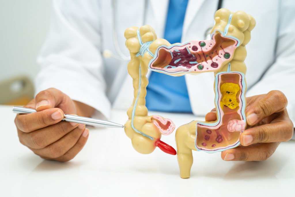 Early Signs of Colon Cancer: What You Shouldn’t Ignore early signs of colon cancer