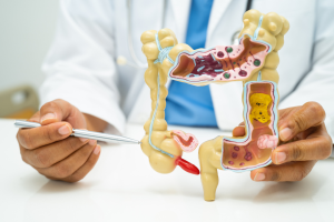 early signs of colon cancer